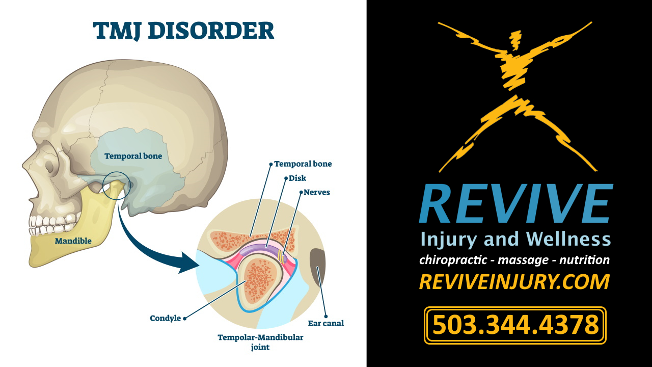 West Linn Oregon Chiropractor TMJ Disorder Jaw Pain Relief