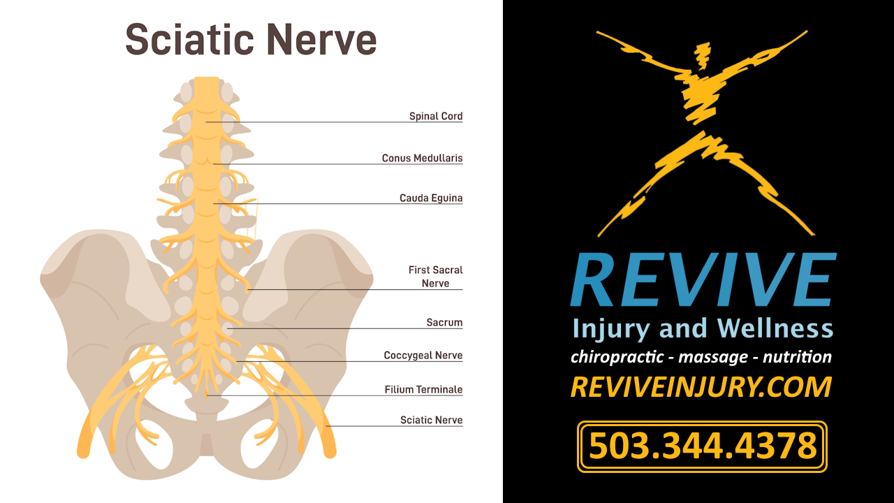 Revive_Injury_Wellness_Sciatic_Nerve_Pain_Sciatica_Graphic_Chiropractor_Chiropractic_Care Revive Injury and Wellness Graphic Diagram of the Sciatic Nerve, Sciatica Pain Relief West Linn Chiropractor and Chiropractic Care