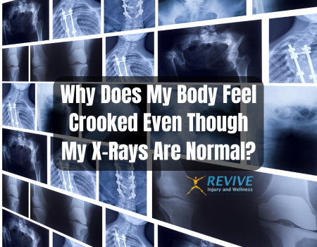 Why Does My Body Feel Crooked Even Though My X-Rays Are Normal?